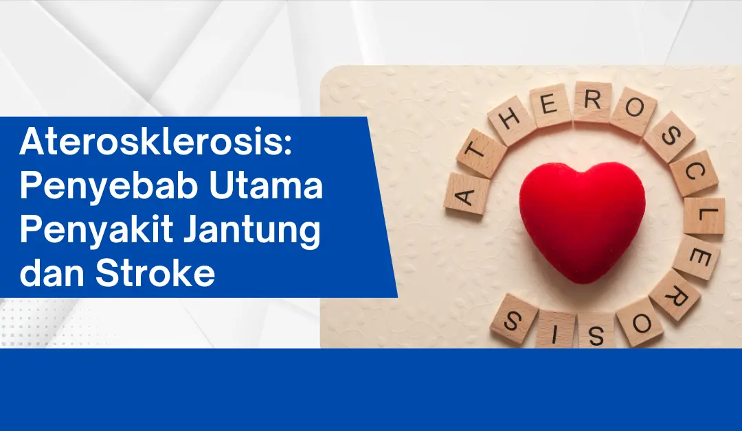 aterosklerosis:-penyebab-utama-penyakit-jantung-dan-stroke