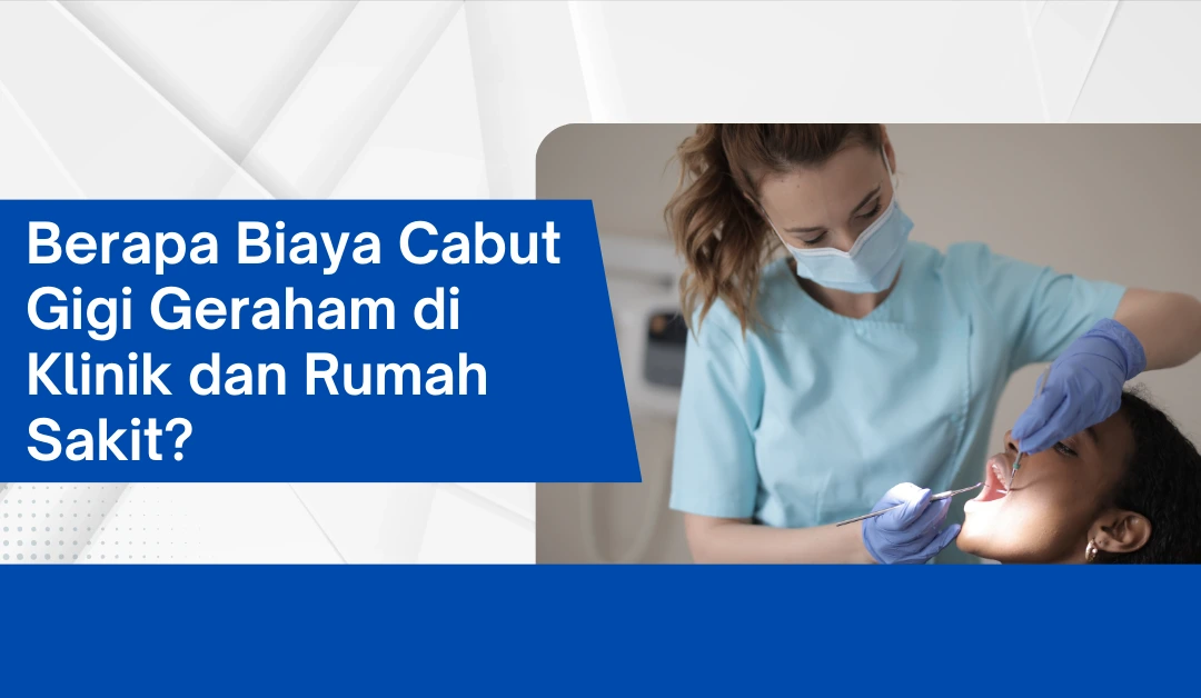 Berapa Biaya Cabut Gigi Geraham di Klinik dan Rumah Sakit?