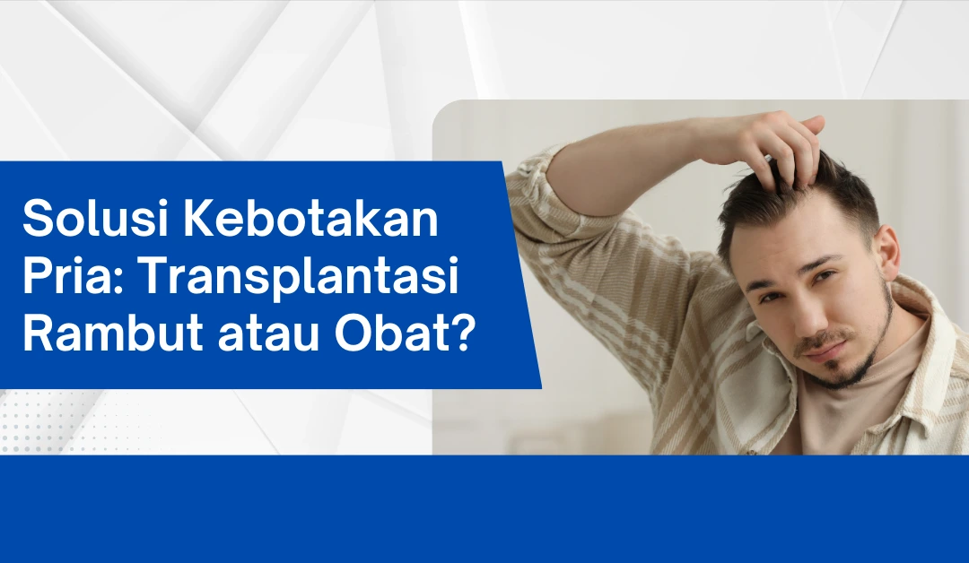 solusi-kebotakan-pria:-transplantasi-rambut-atau-obat?